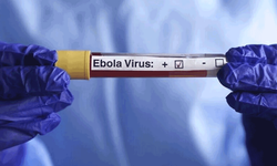 Kenya'da Ebola vakası sayısı 8'e yükseldi