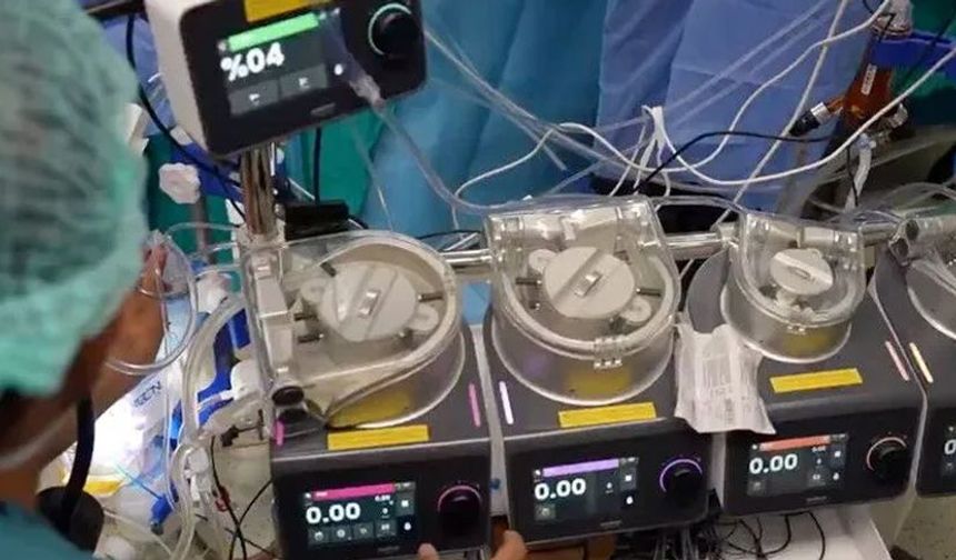 Yerli ve milli kalp-akciğer makinesi 57 hastada başarıyla kullanıldı