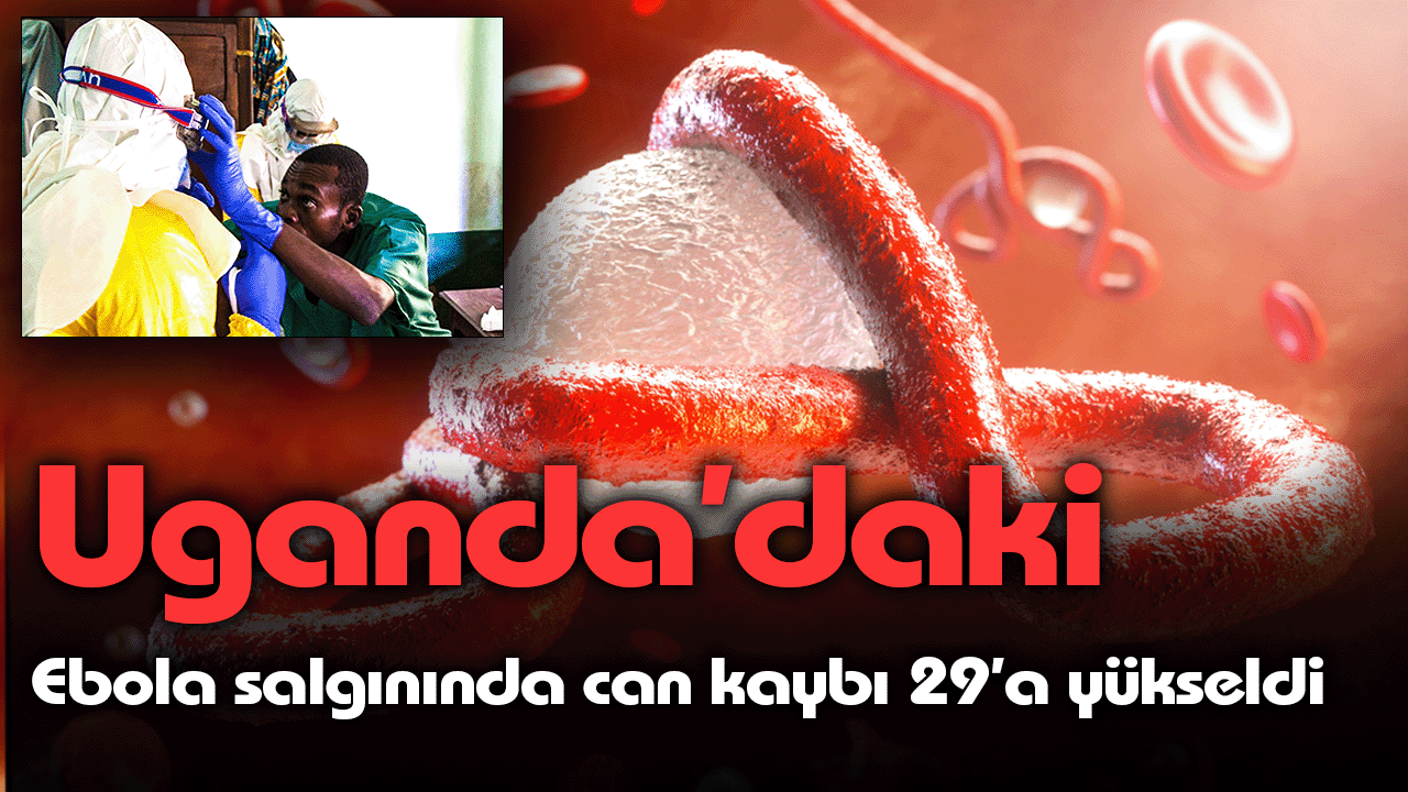 Uganda’daki Ebola salgınında can kaybı 29’a yükseldi